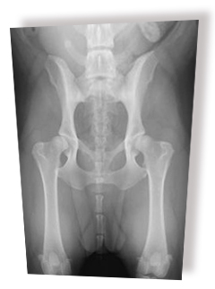 csukló deformáció osteoarthrosis kezelés